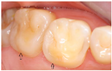 Dentistry 13 00249 i002 Dentistry 13 00249 i002