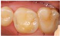 Dentistry 13 00249 i005 Dentistry 13 00249 i005