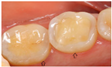 Dentistry 13 00249 i006 Dentistry 13 00249 i006