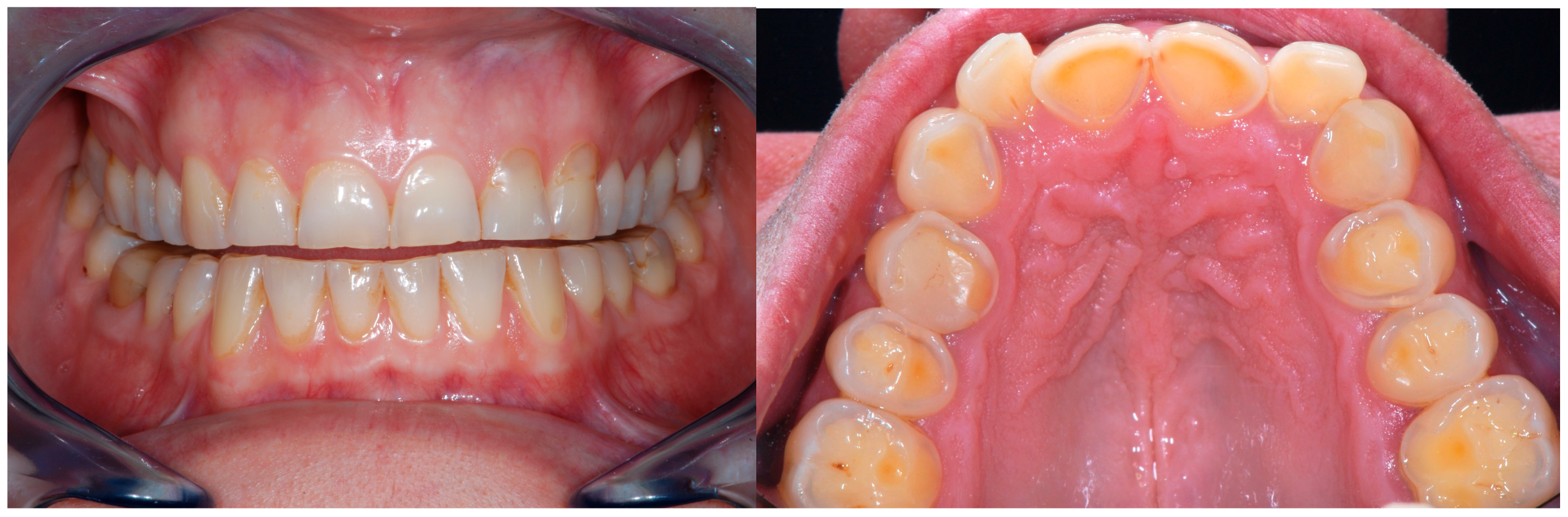 Dentistry 13 00259 g001 Dentistry 13 00259 g001