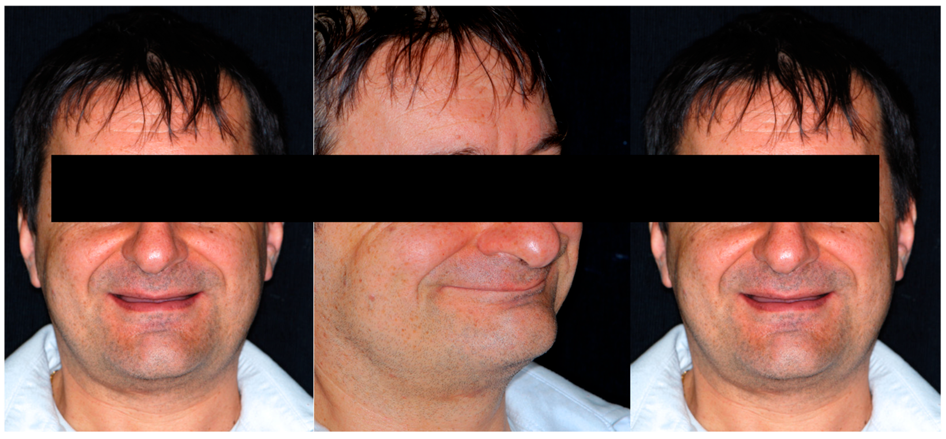 Dentistry 13 00259 g002 Dentistry 13 00259 g002