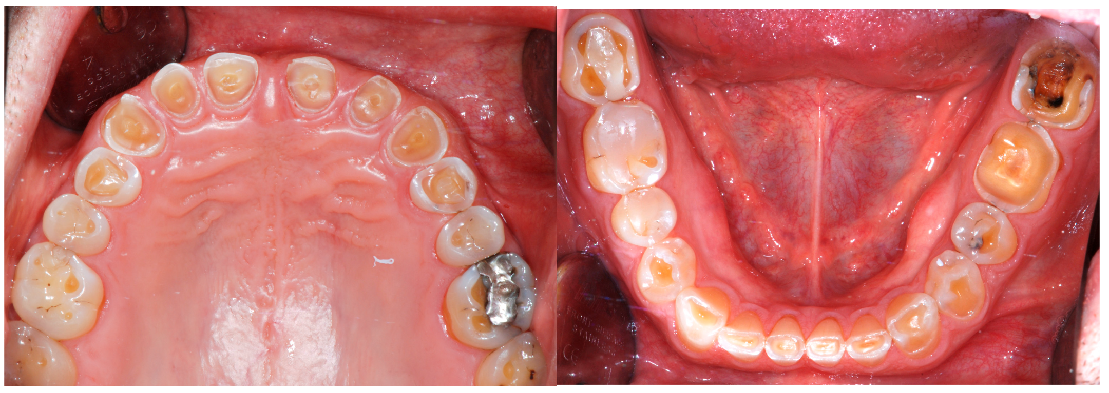 Dentistry 13 00259 g003 Dentistry 13 00259 g003