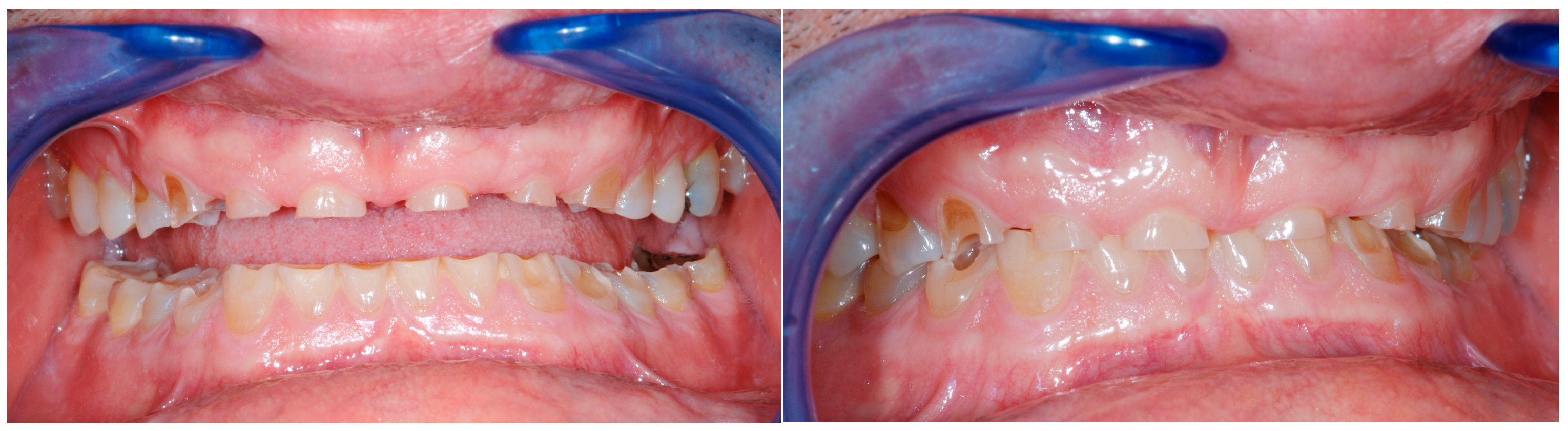 Dentistry 13 00259 g004 Dentistry 13 00259 g004