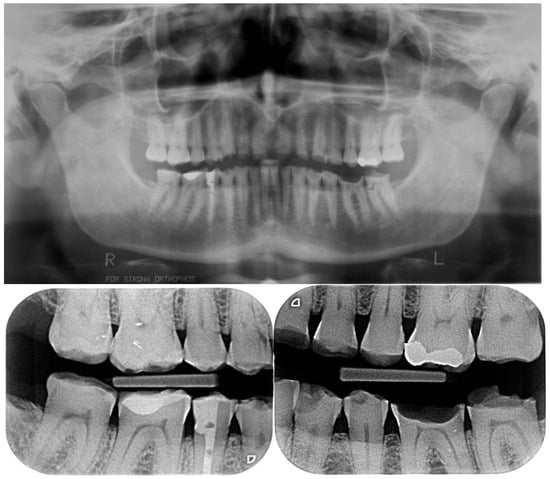 Dentistry 13 00259 g005a Dentistry 13 00259 g005a