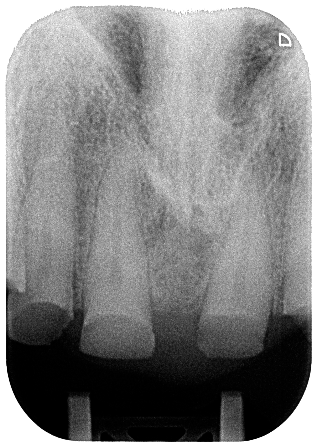 Dentistry 13 00259 g005b Dentistry 13 00259 g005b