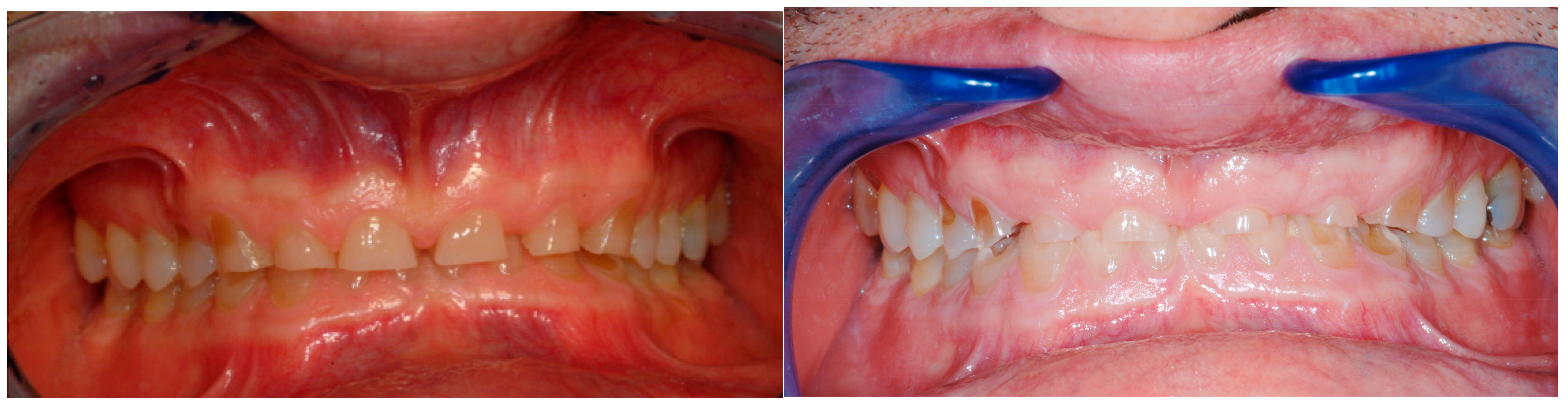 Dentistry 13 00259 g006 Dentistry 13 00259 g006