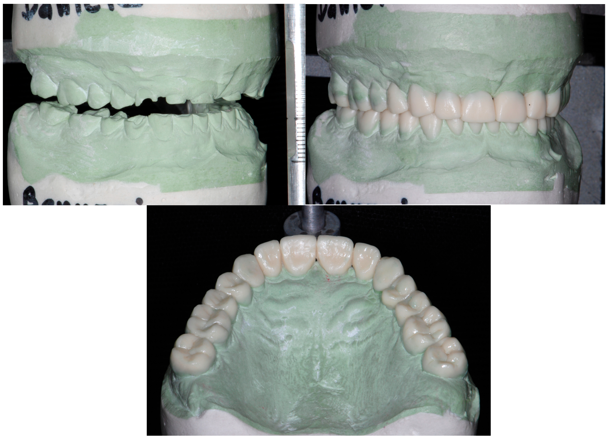 Dentistry 13 00259 g007 Dentistry 13 00259 g007