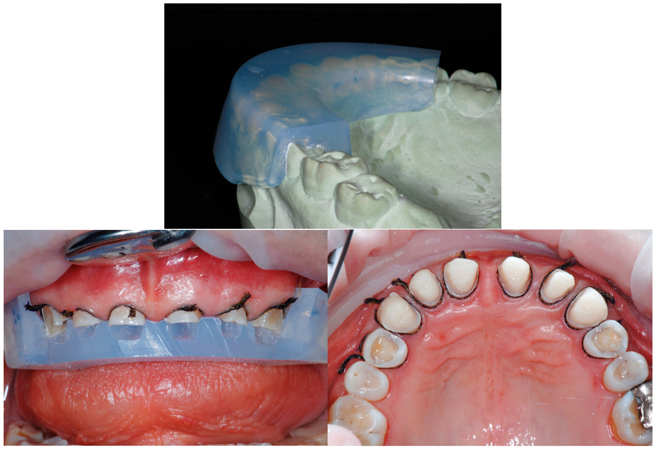Dentistry 13 00259 g008b Dentistry 13 00259 g008b