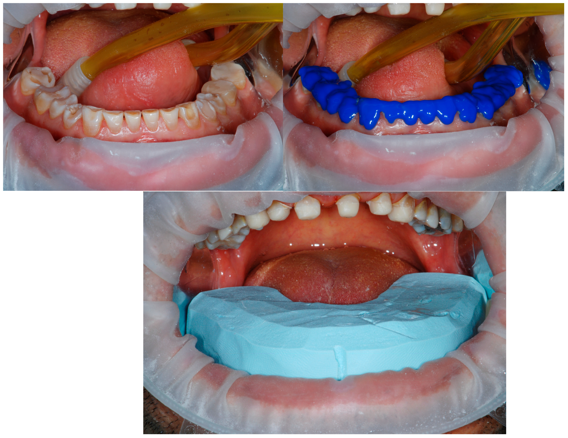 Dentistry 13 00259 g009 Dentistry 13 00259 g009