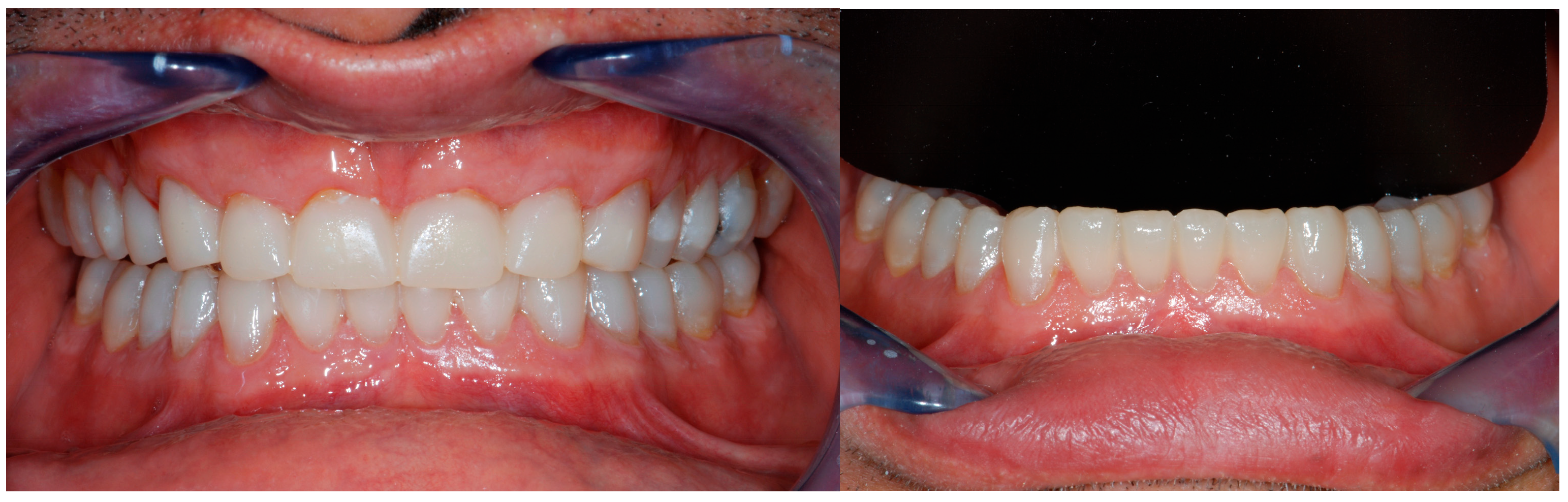 Dentistry 13 00259 g010 Dentistry 13 00259 g010