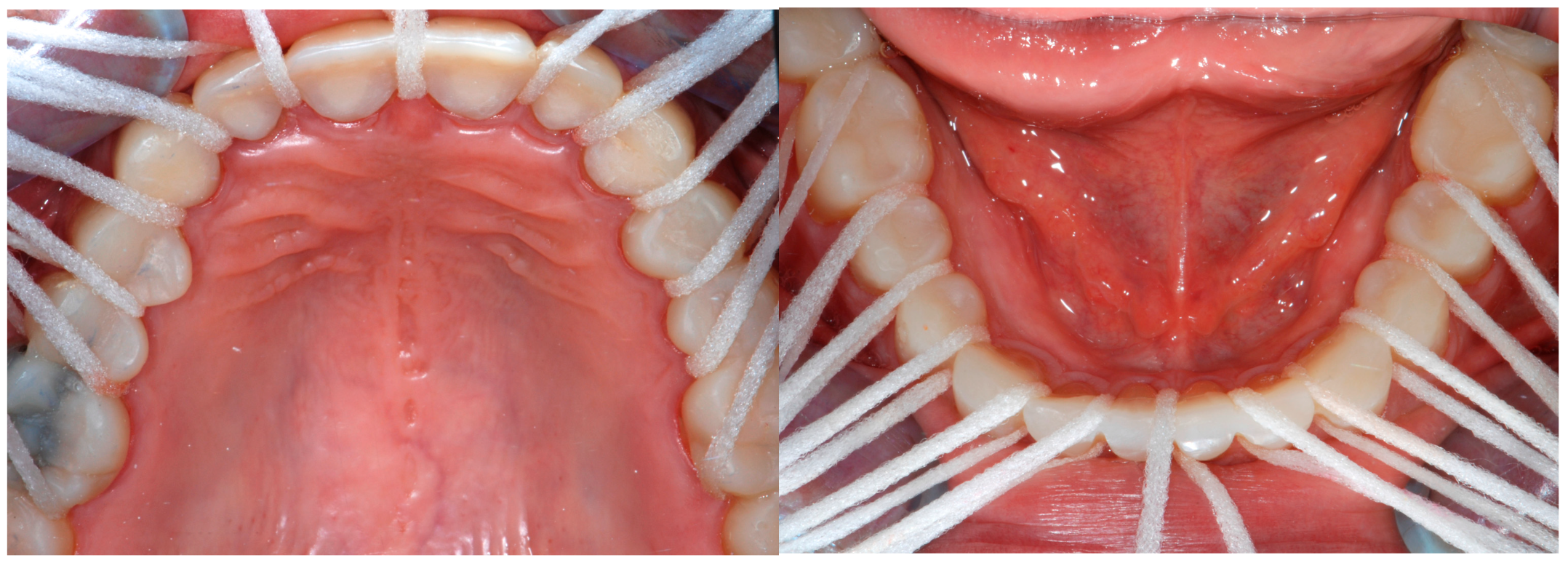 Dentistry 13 00259 g011 Dentistry 13 00259 g011