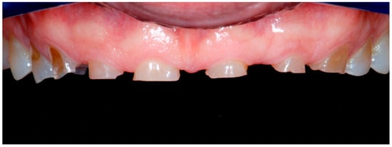 Dentistry 13 00259 g012a Dentistry 13 00259 g012a