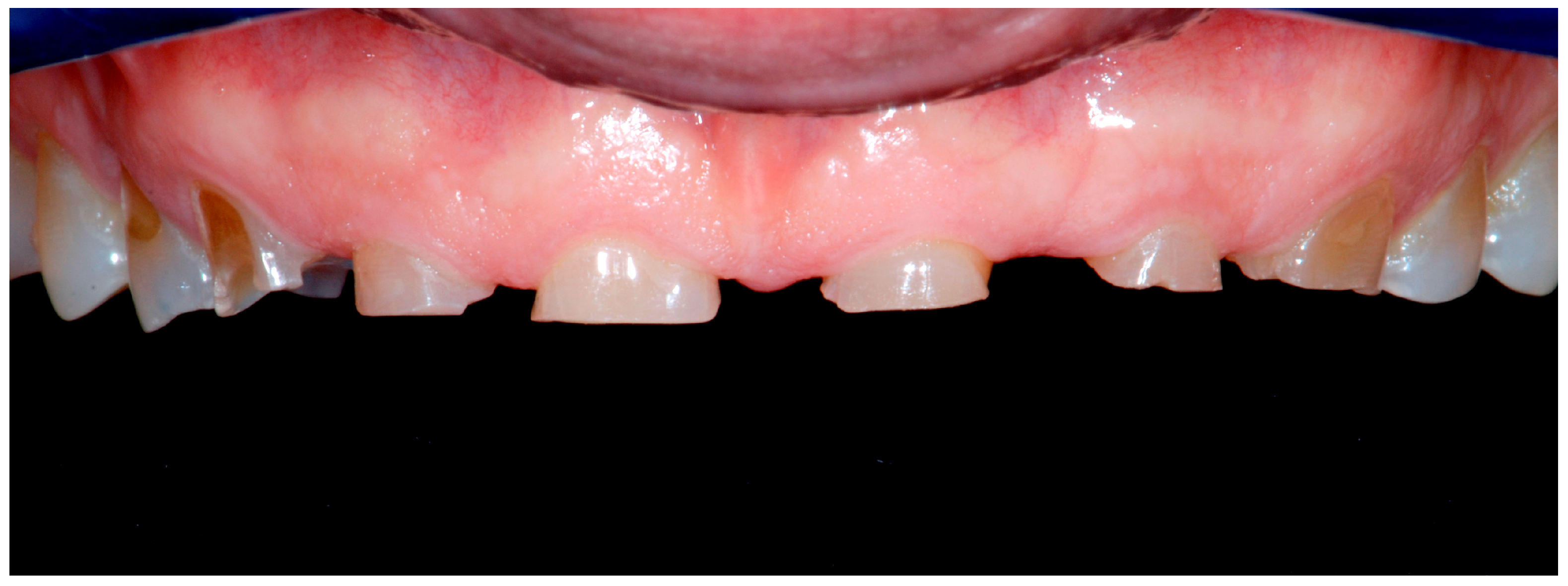 Dentistry 13 00259 g012a Dentistry 13 00259 g012a