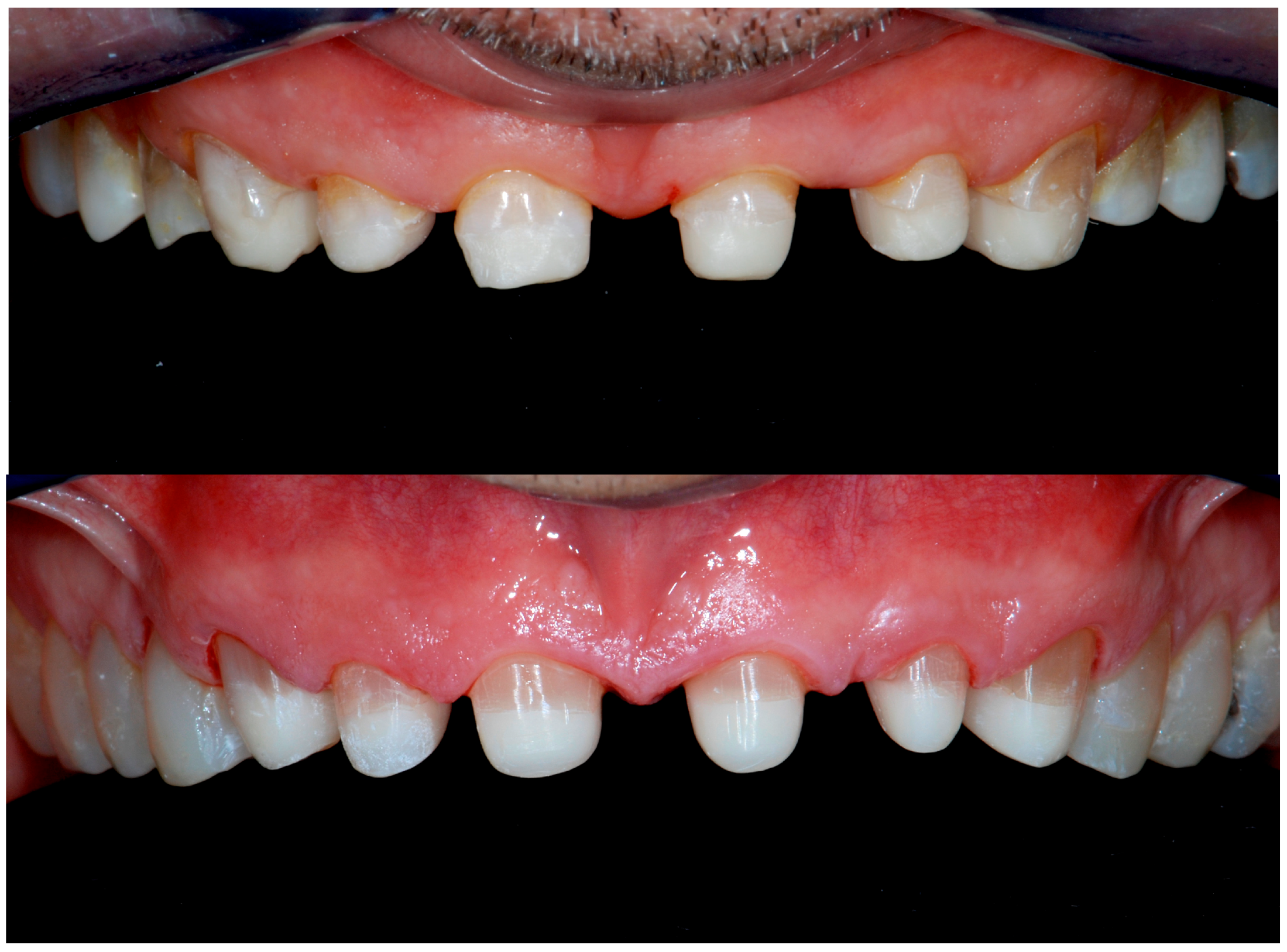 Dentistry 13 00259 g012b Dentistry 13 00259 g012b