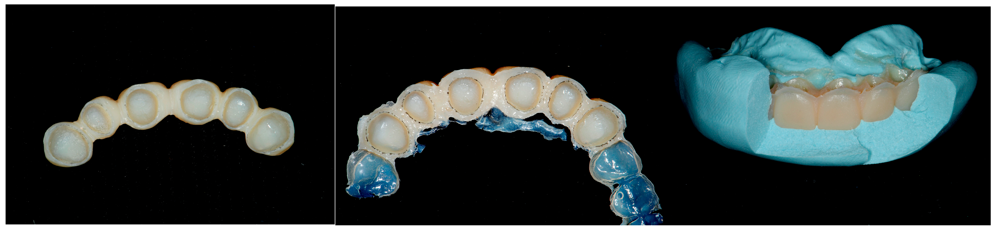 Dentistry 13 00259 g013 Dentistry 13 00259 g013