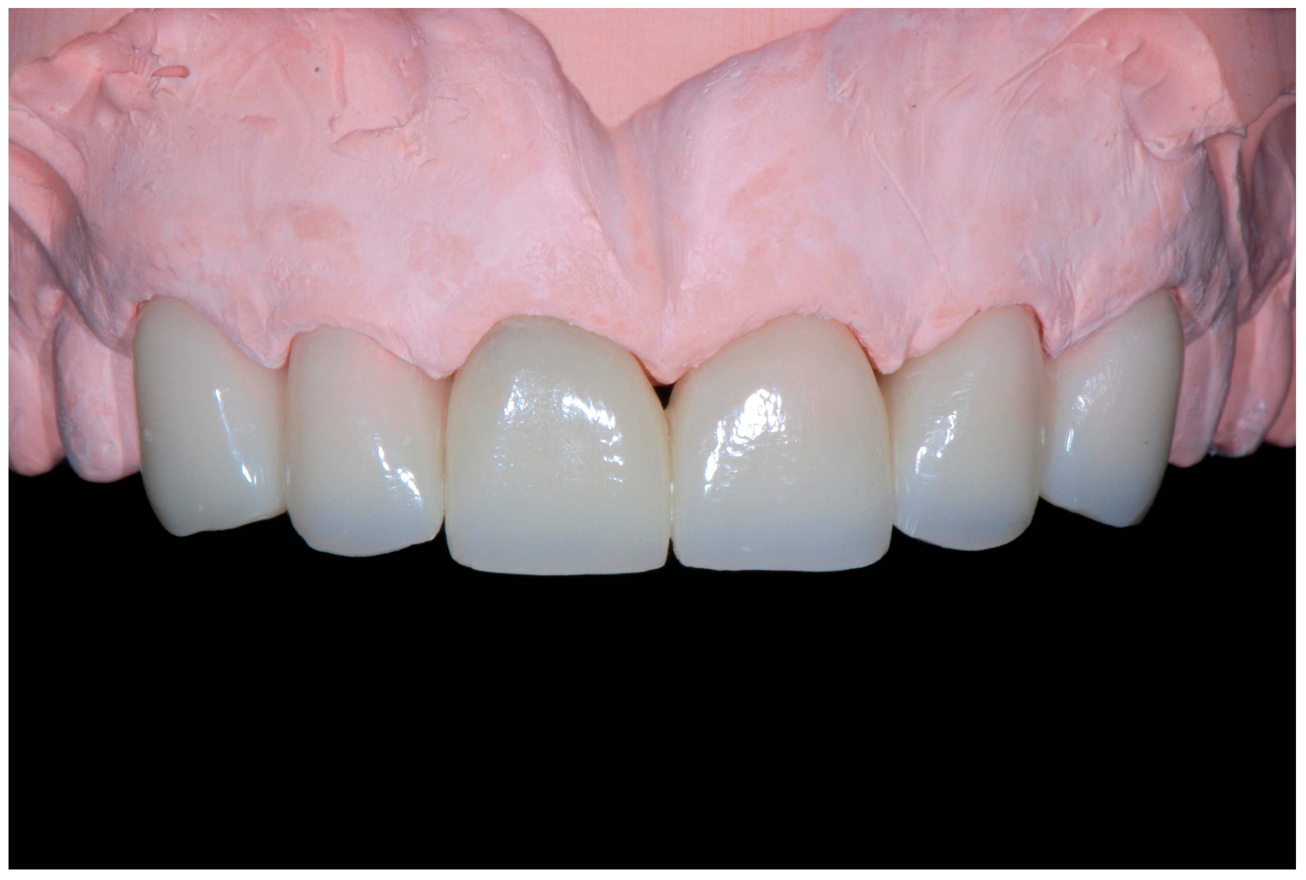 Dentistry 13 00259 g014 Dentistry 13 00259 g014