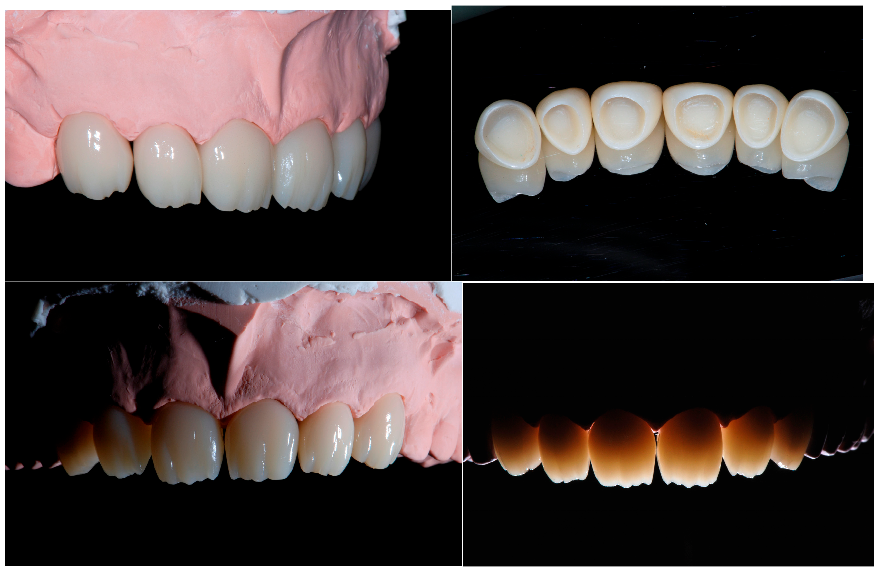 Dentistry 13 00259 g015 Dentistry 13 00259 g015