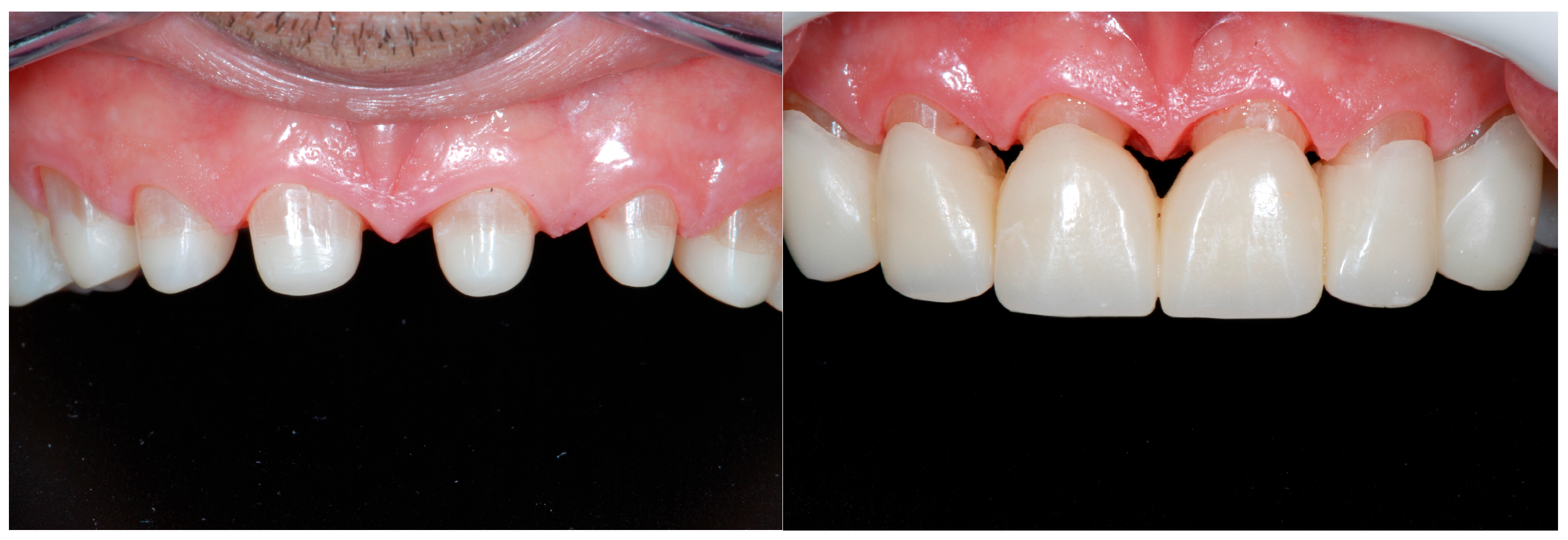Dentistry 13 00259 g016 Dentistry 13 00259 g016