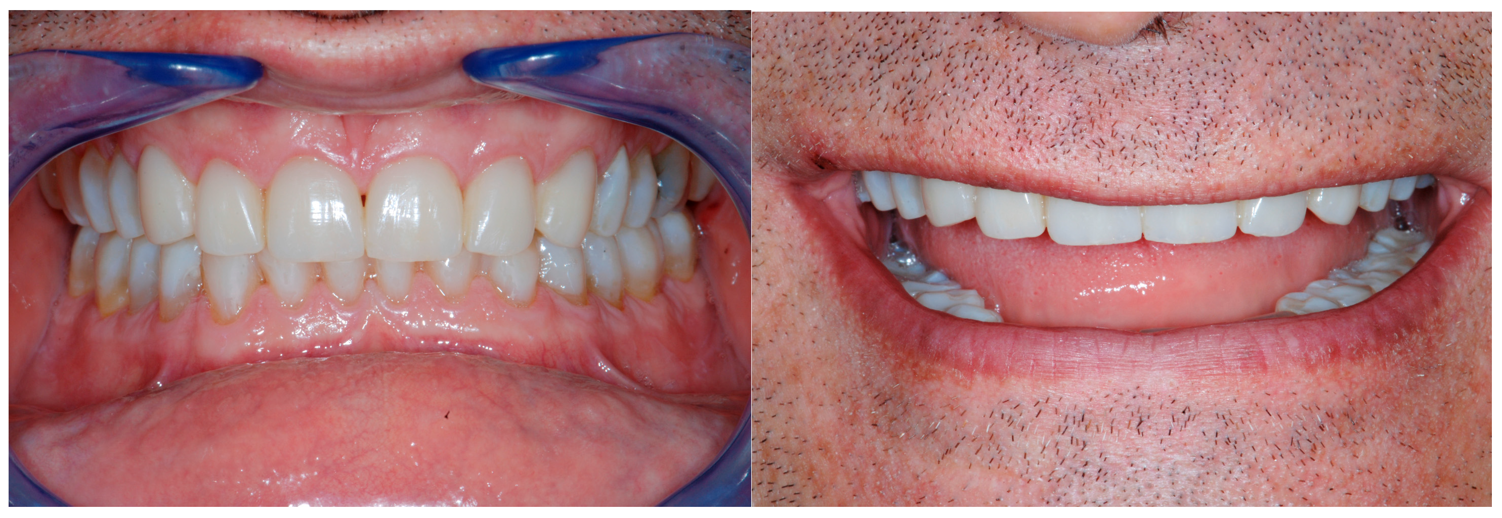 Dentistry 13 00259 g017 Dentistry 13 00259 g017