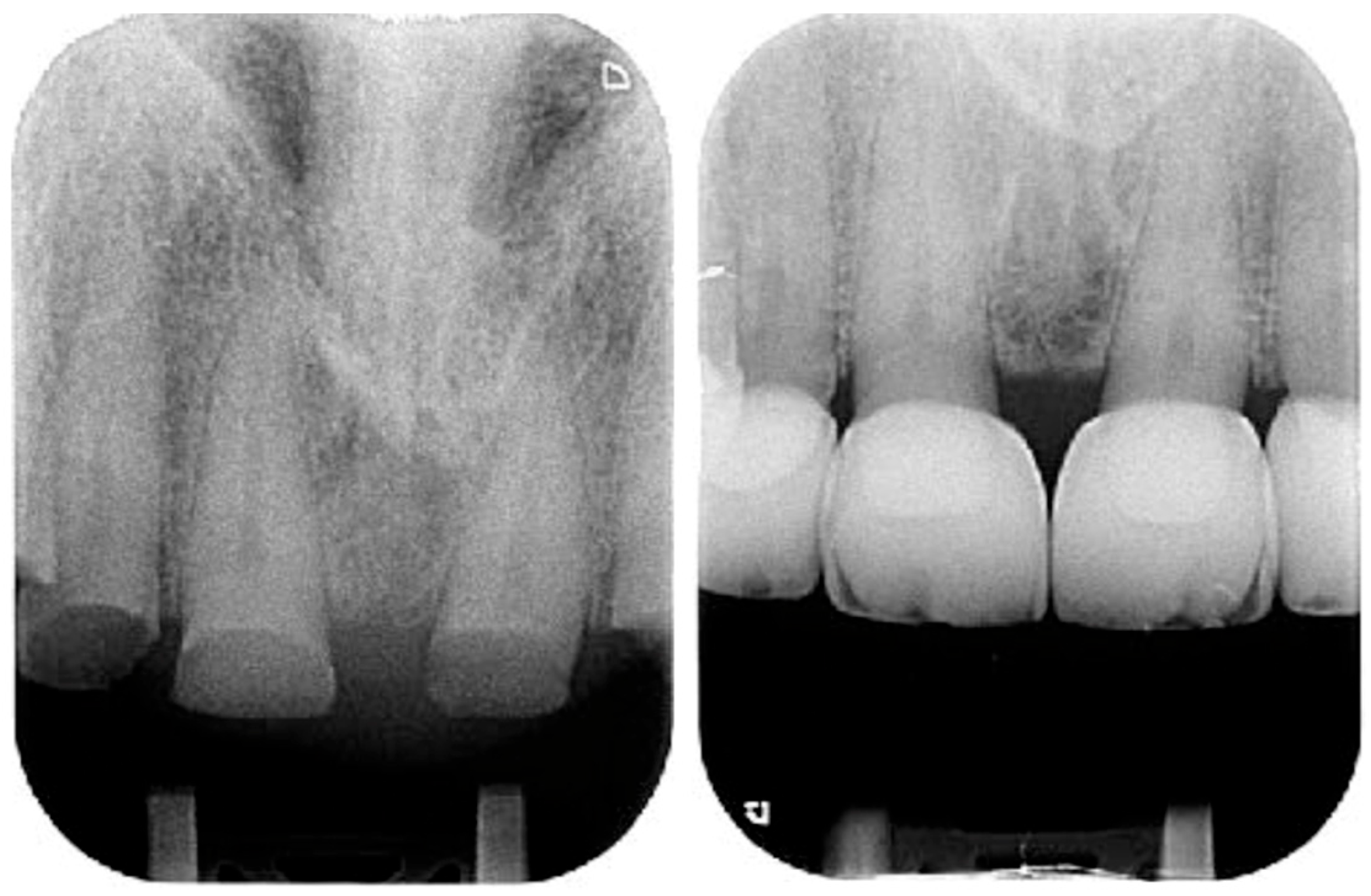 Dentistry 13 00259 g018 Dentistry 13 00259 g018