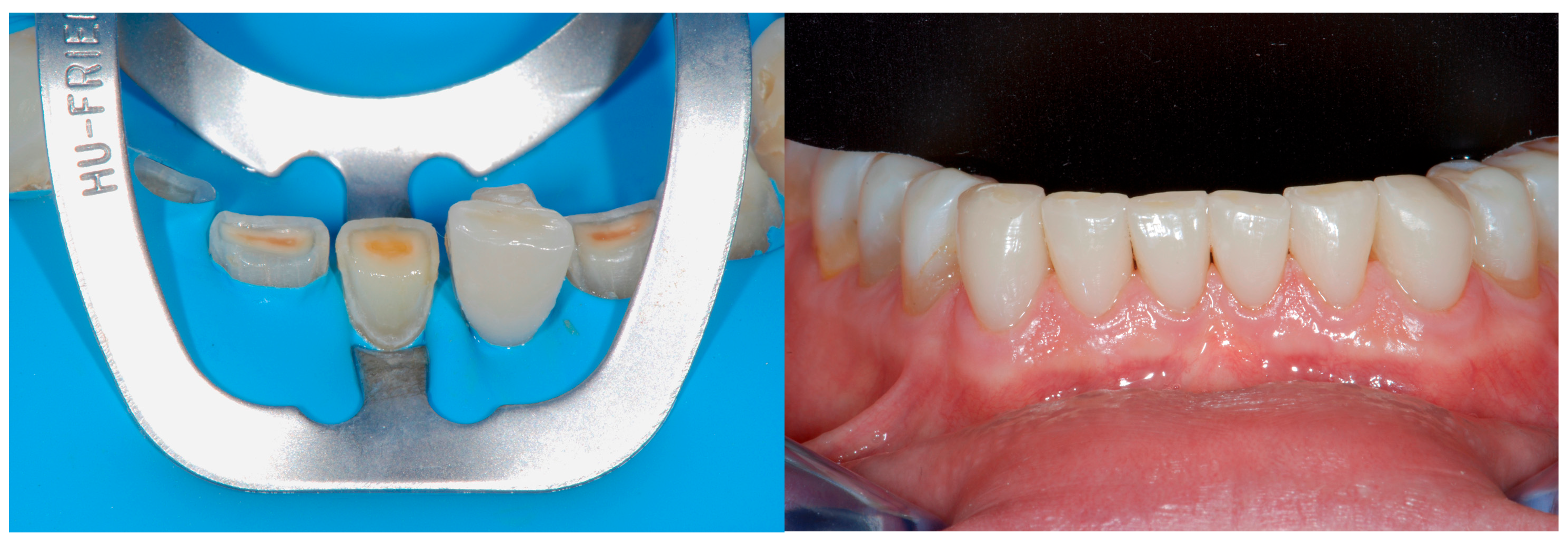 Dentistry 13 00259 g019 Dentistry 13 00259 g019