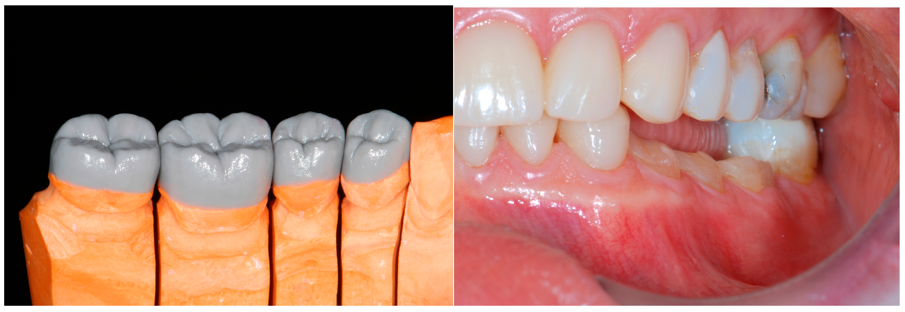 Dentistry 13 00259 g020 Dentistry 13 00259 g020