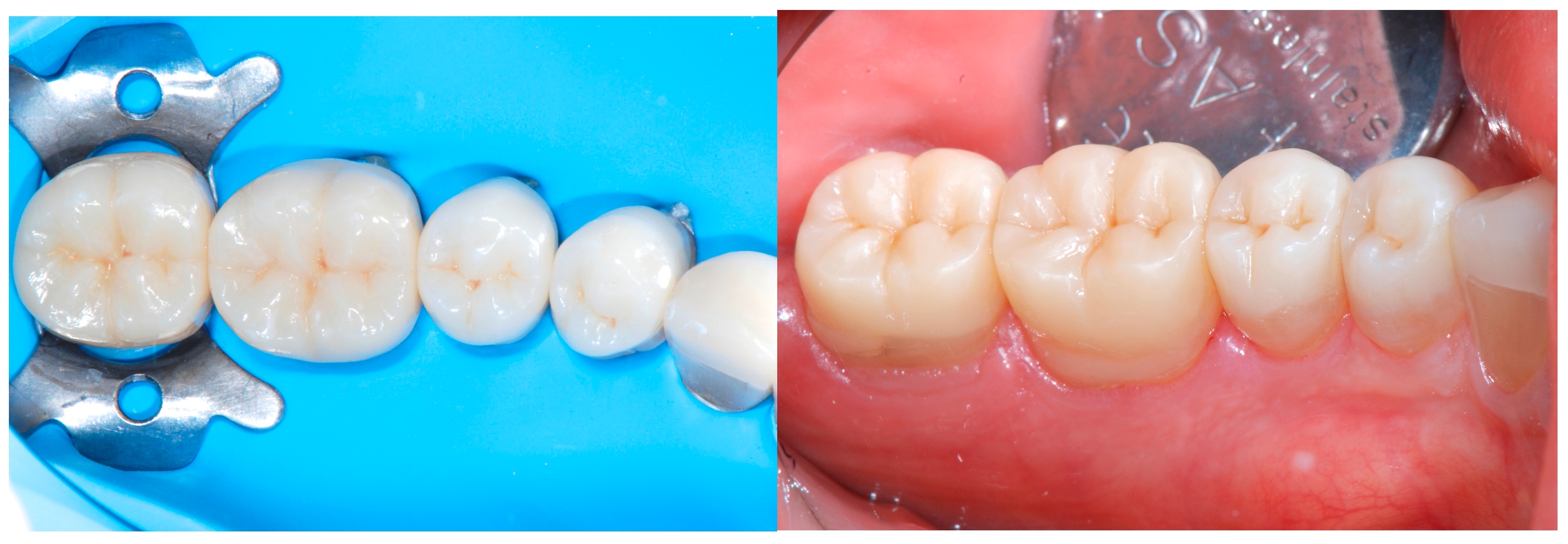 Dentistry 13 00259 g021 Dentistry 13 00259 g021