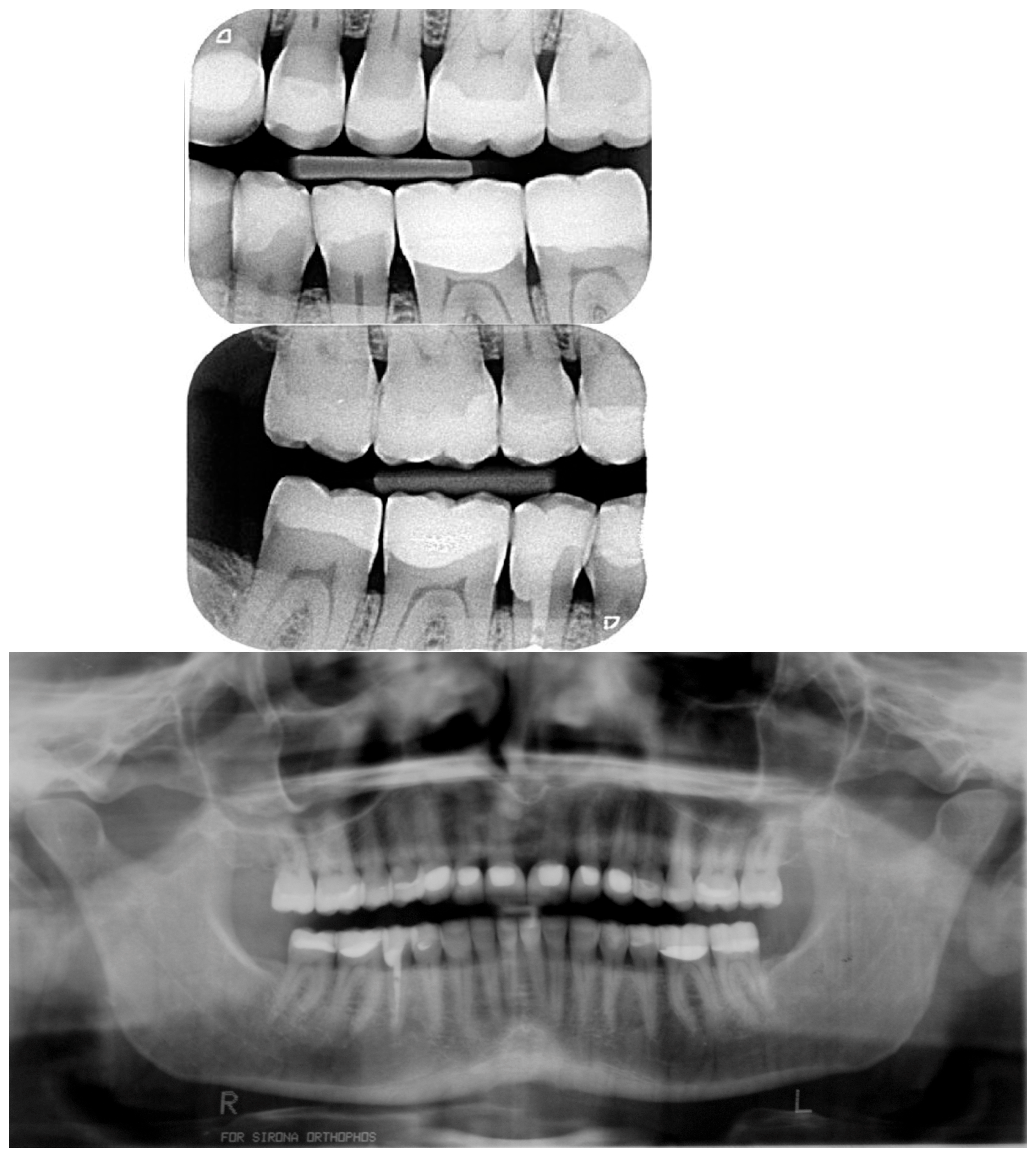 Dentistry 13 00259 g022 Dentistry 13 00259 g022