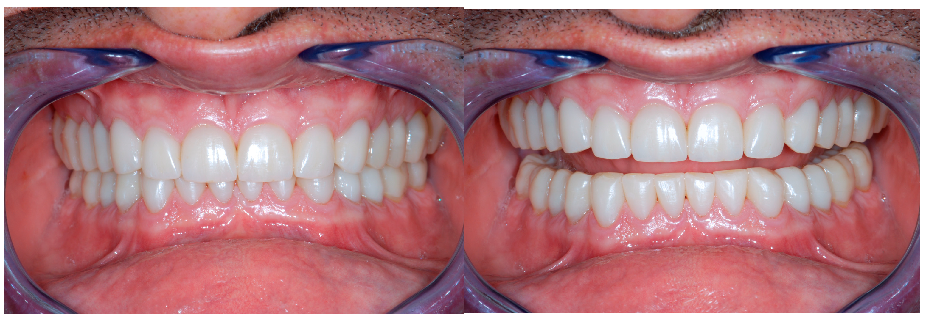 Dentistry 13 00259 g023 Dentistry 13 00259 g023