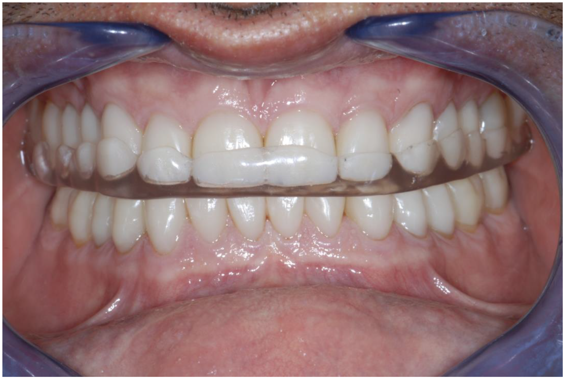 Dentistry 13 00259 g024 Dentistry 13 00259 g024