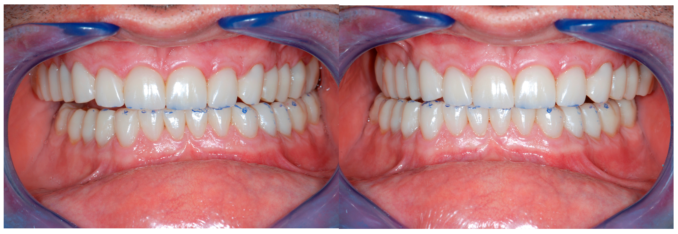 Dentistry 13 00259 g025a Dentistry 13 00259 g025a