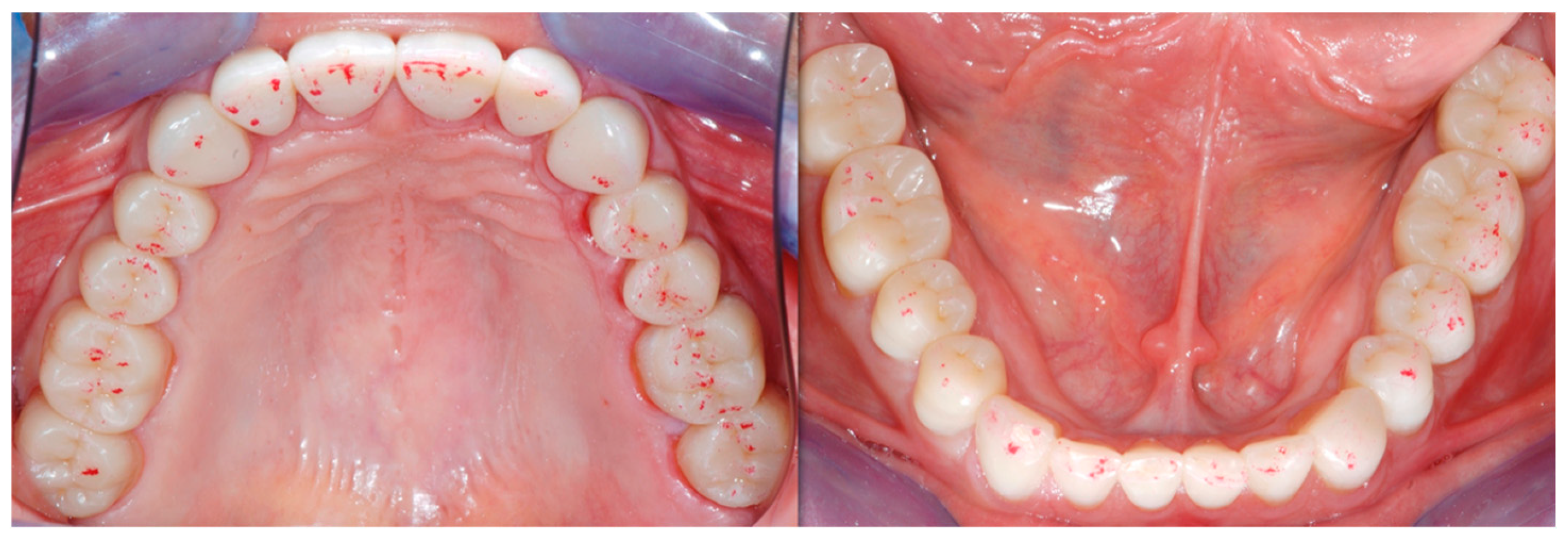 Dentistry 13 00259 g025b Dentistry 13 00259 g025b