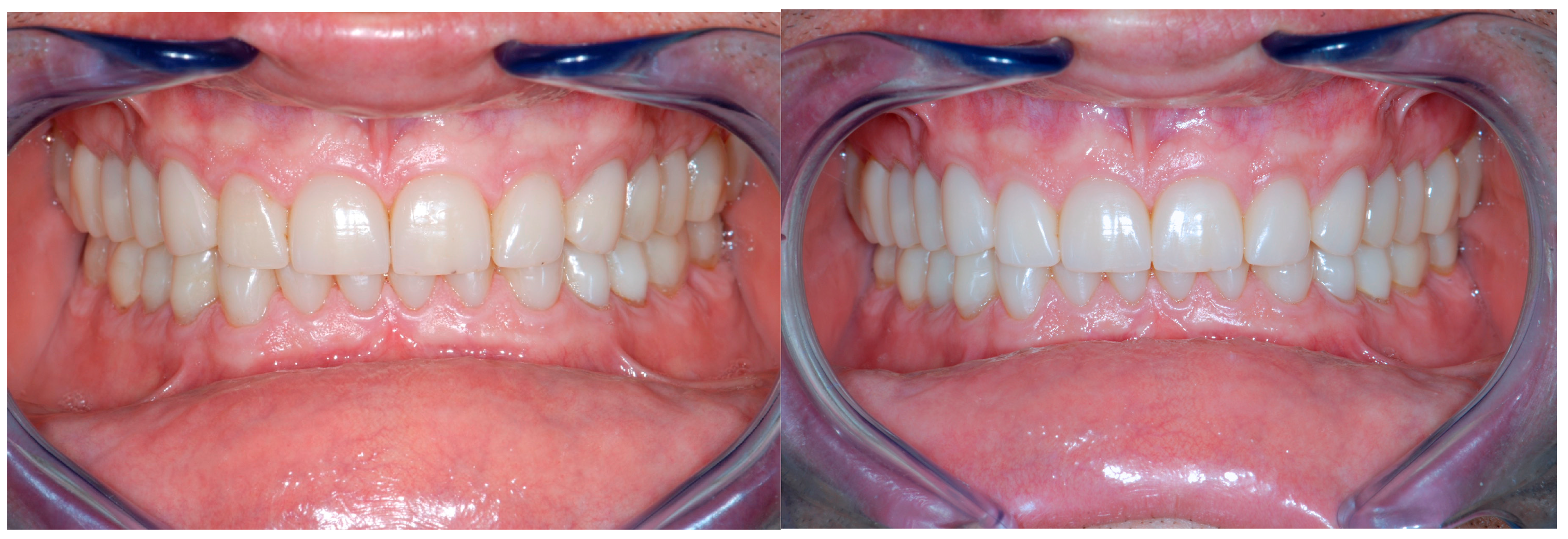 Dentistry 13 00259 g026 Dentistry 13 00259 g026
