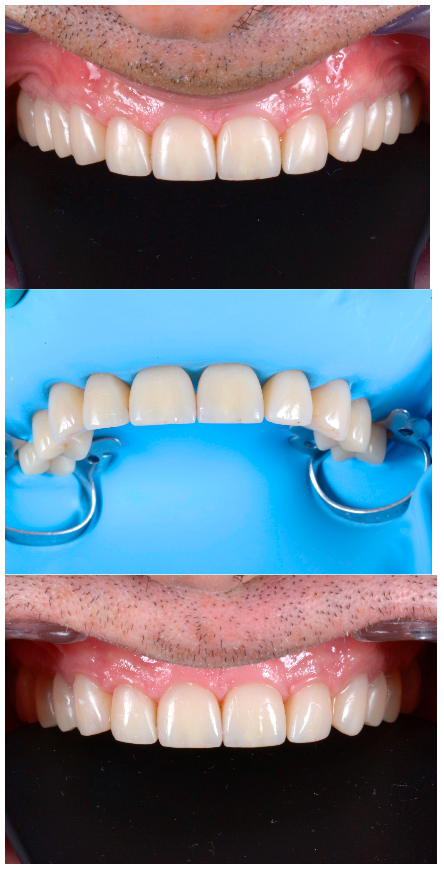 Dentistry 13 00259 g027 Dentistry 13 00259 g027