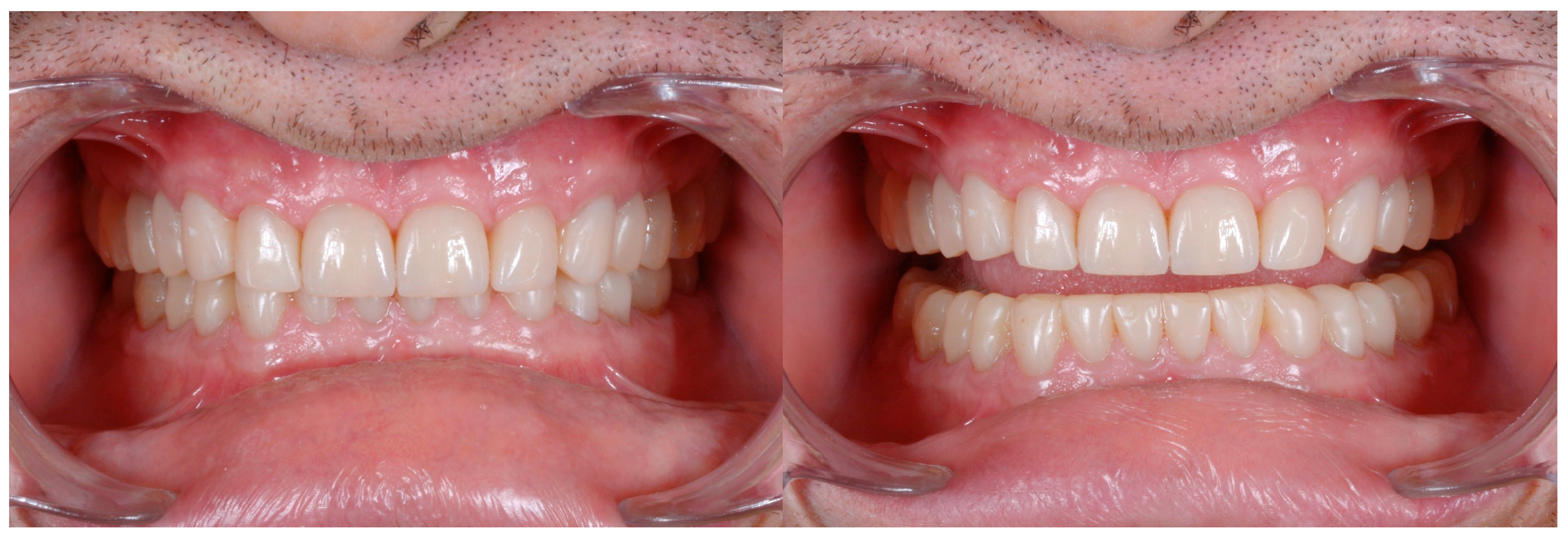 Dentistry 13 00259 g029 Dentistry 13 00259 g029