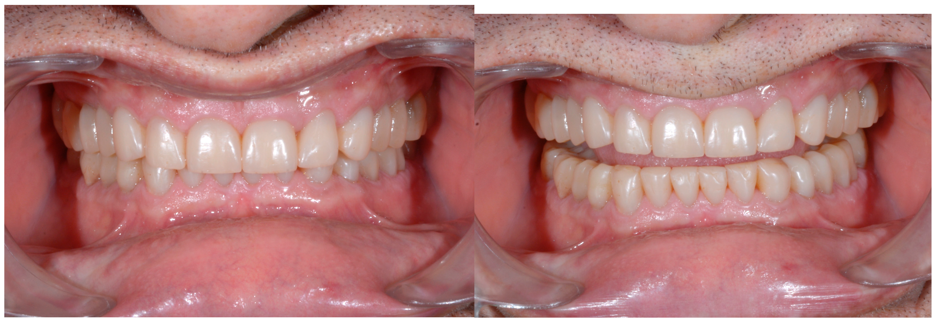 Dentistry 13 00259 g030 Dentistry 13 00259 g030