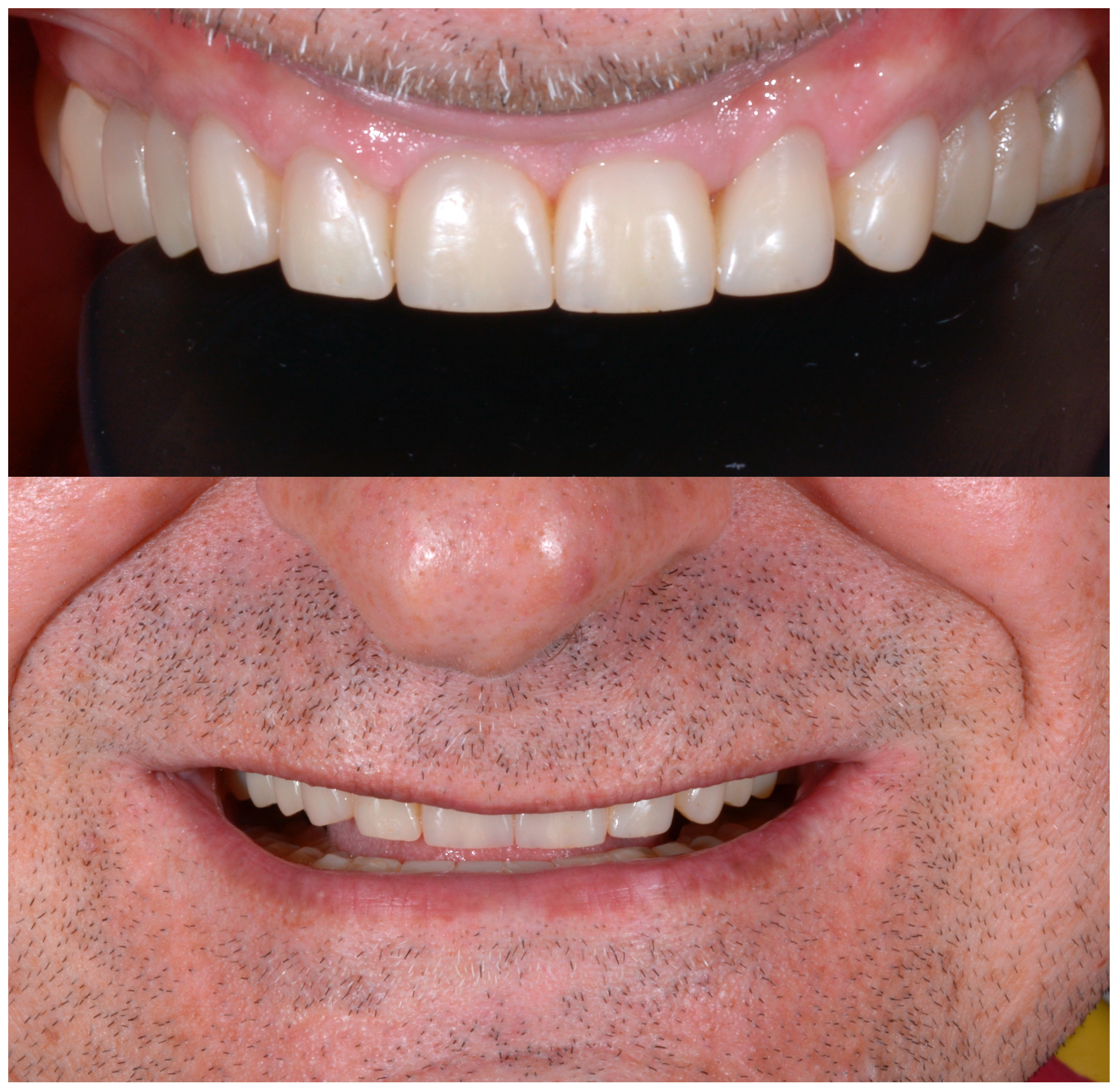 Dentistry 13 00259 g031 Dentistry 13 00259 g031