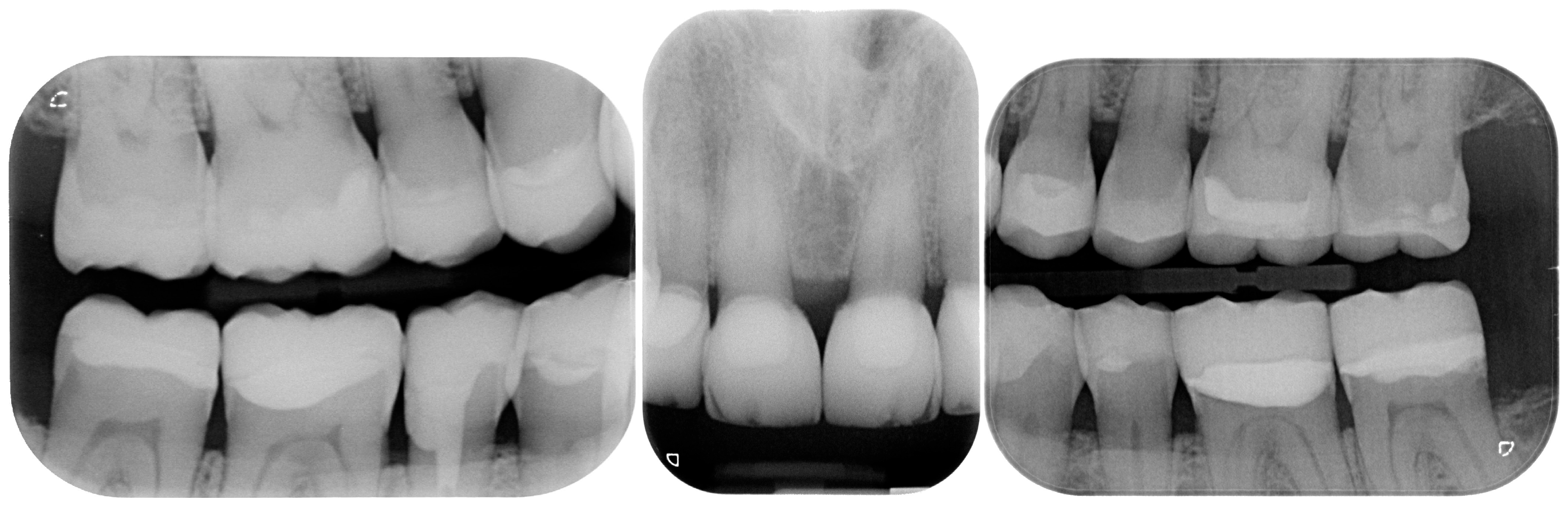 Dentistry 13 00259 g032 Dentistry 13 00259 g032