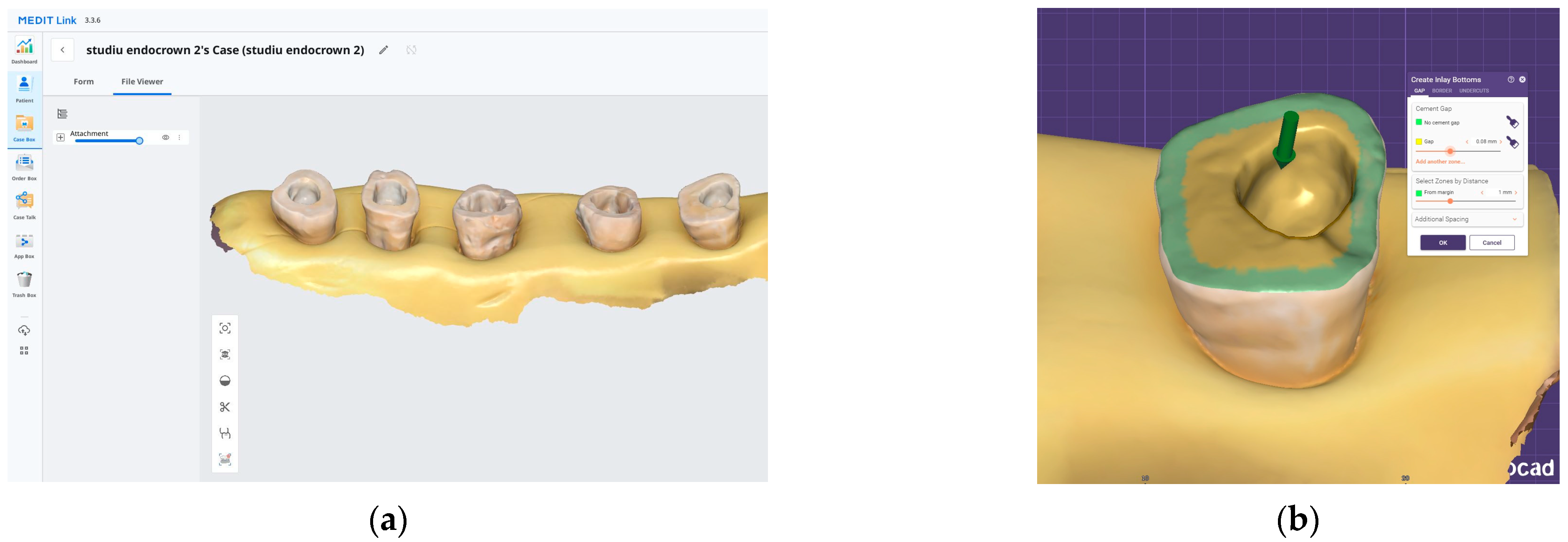 Dentistry 13 00263 g001