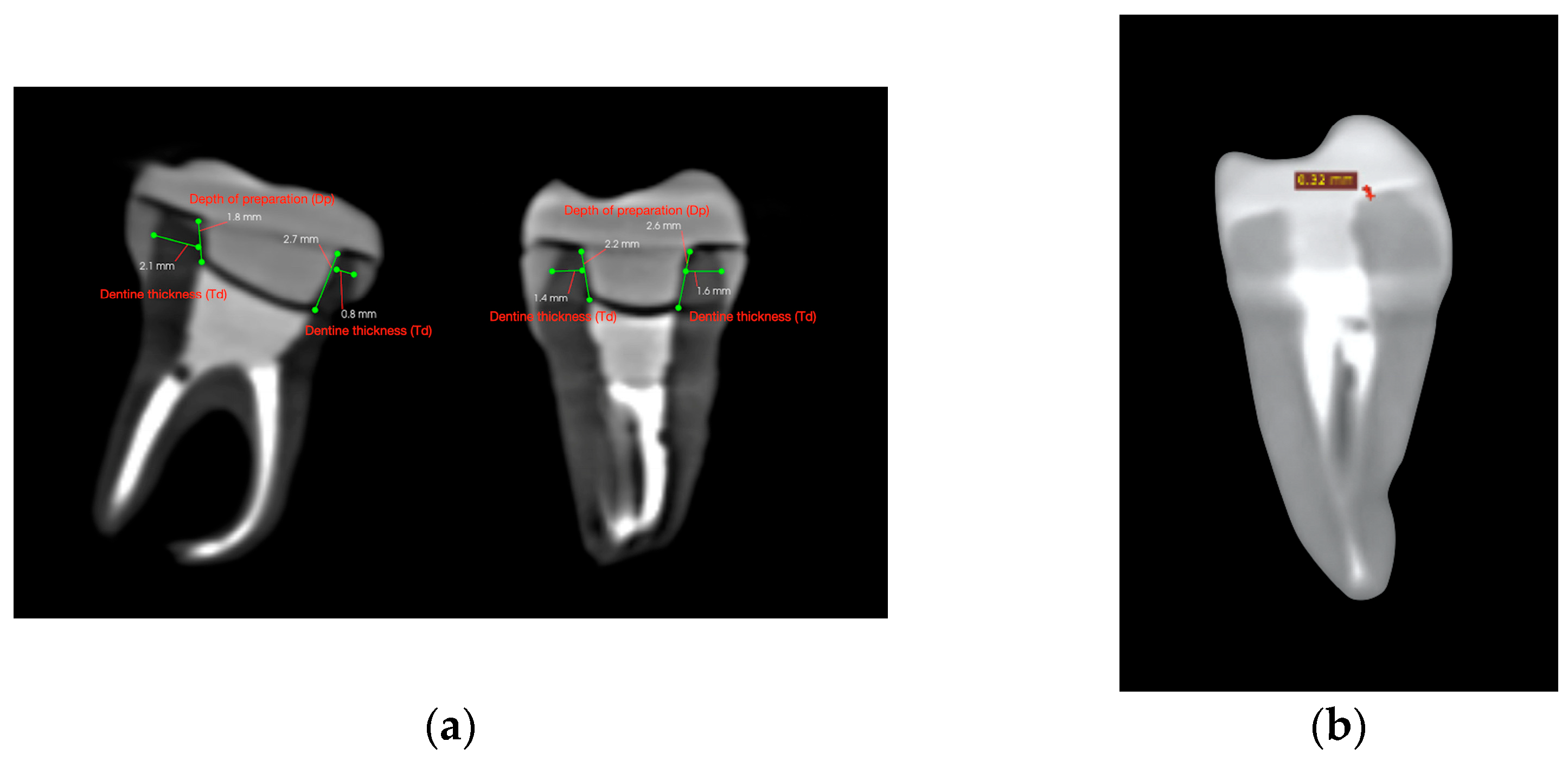 Dentistry 13 00263 g002