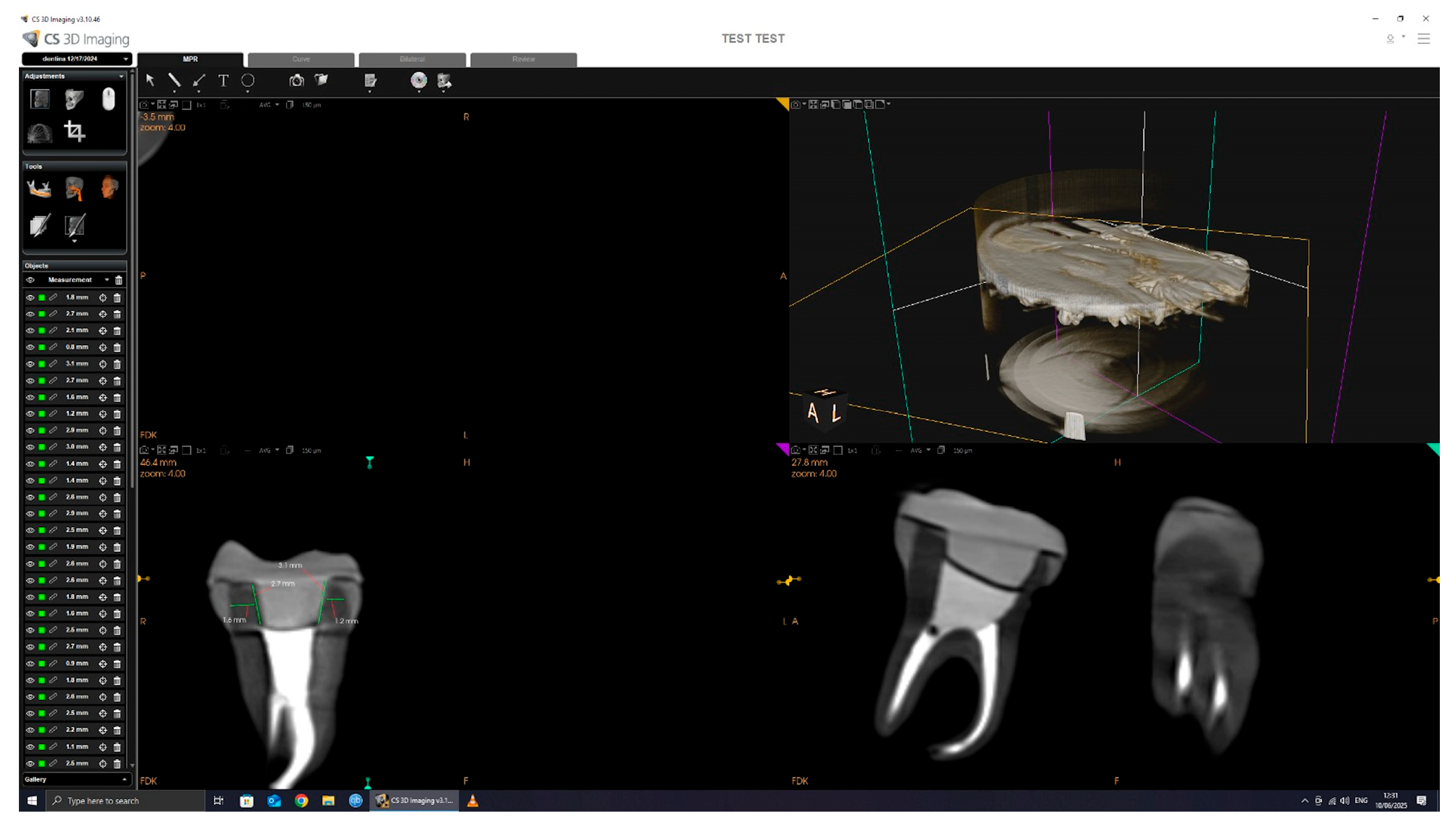 Dentistry 13 00263 g004