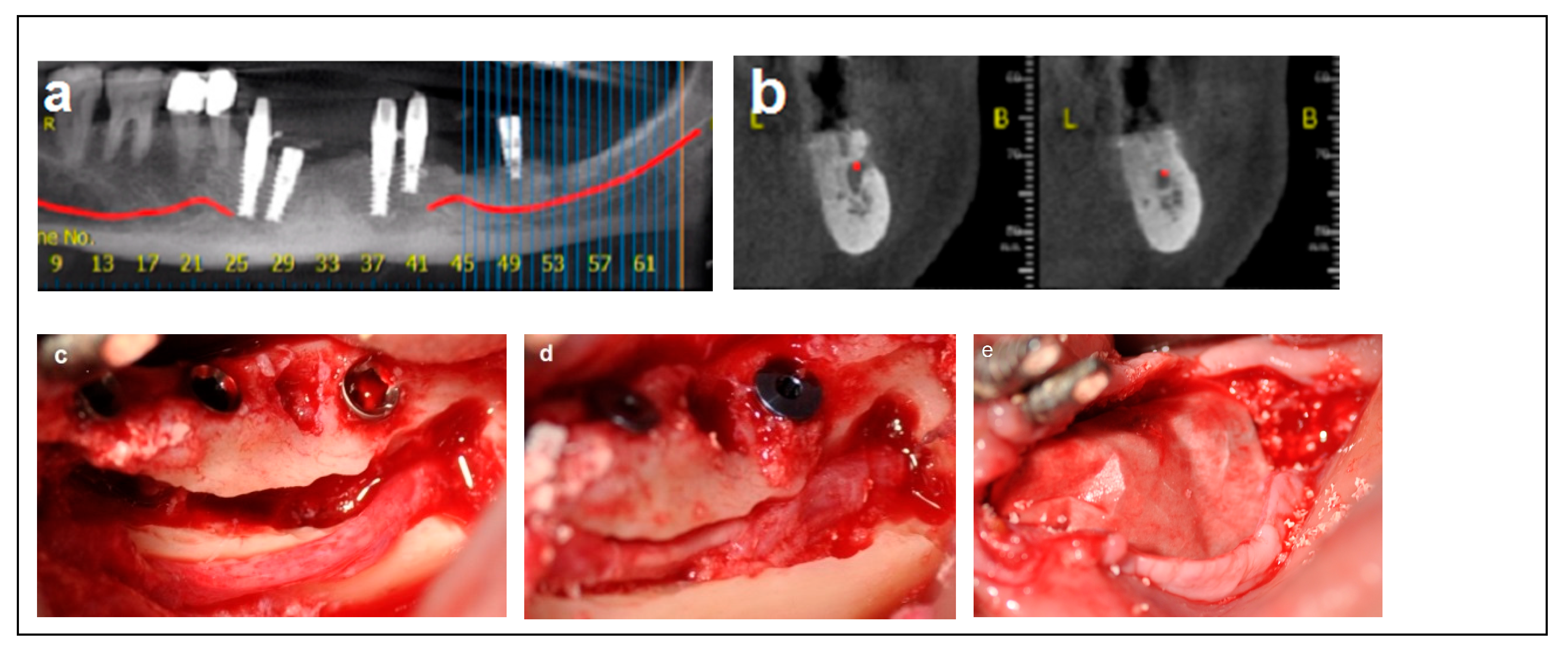 Dentistry 13 00267 g002a