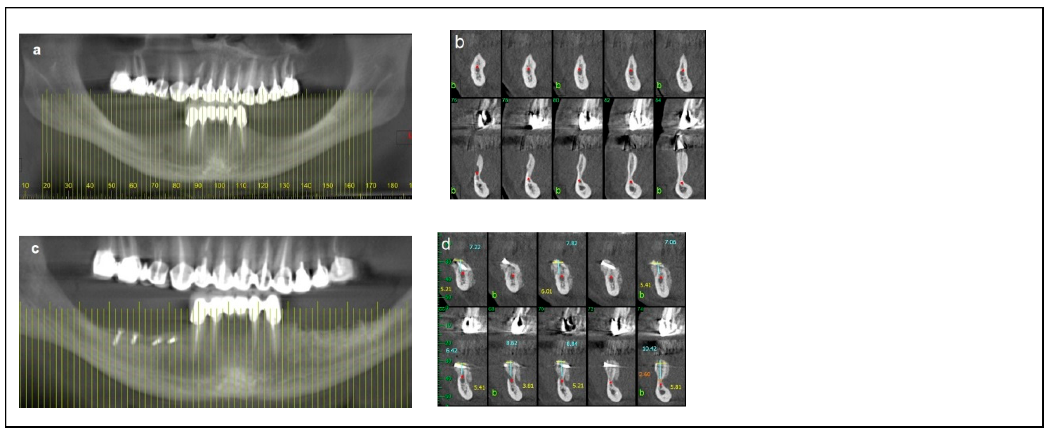 Dentistry 13 00267 g003a