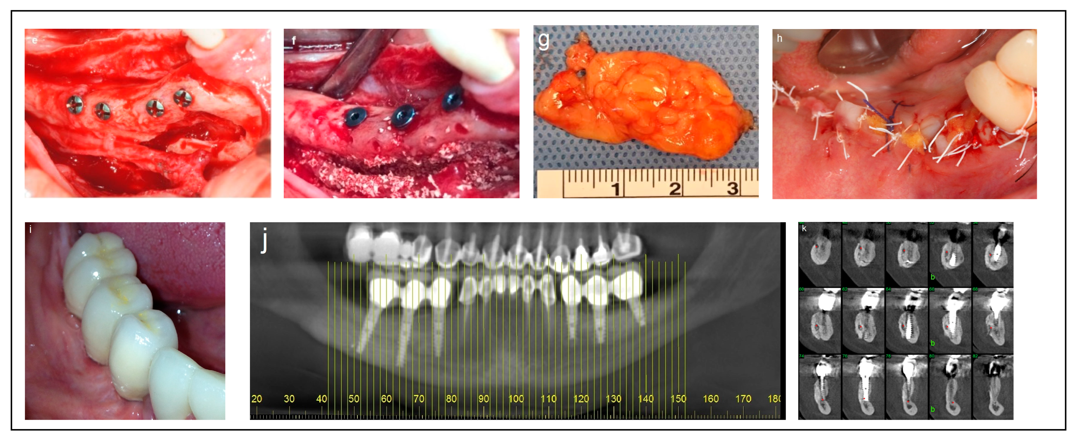 Dentistry 13 00267 g003b
