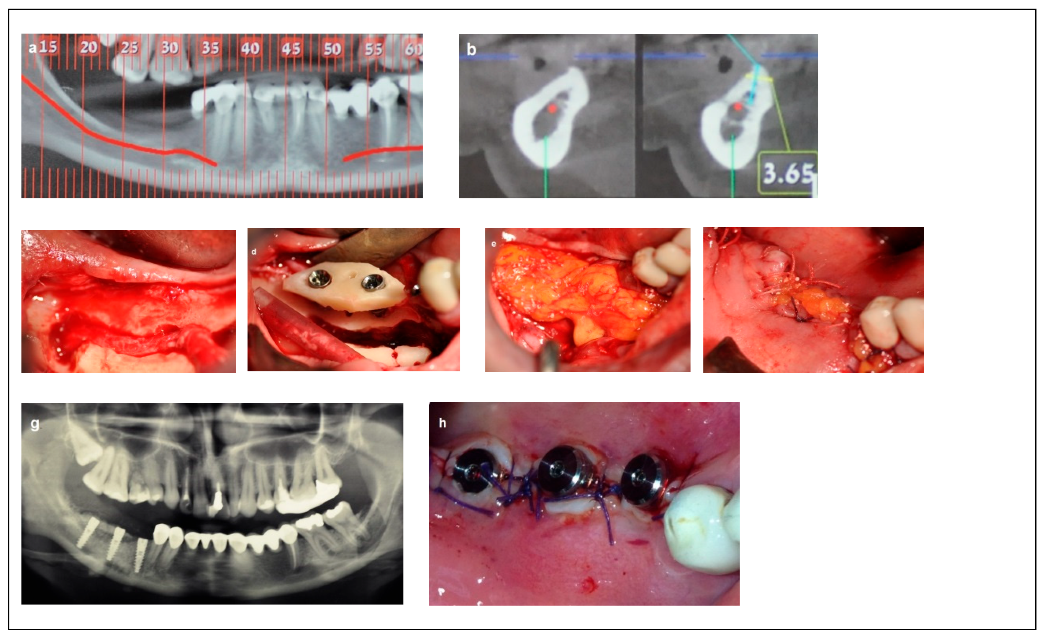 Dentistry 13 00267 g004