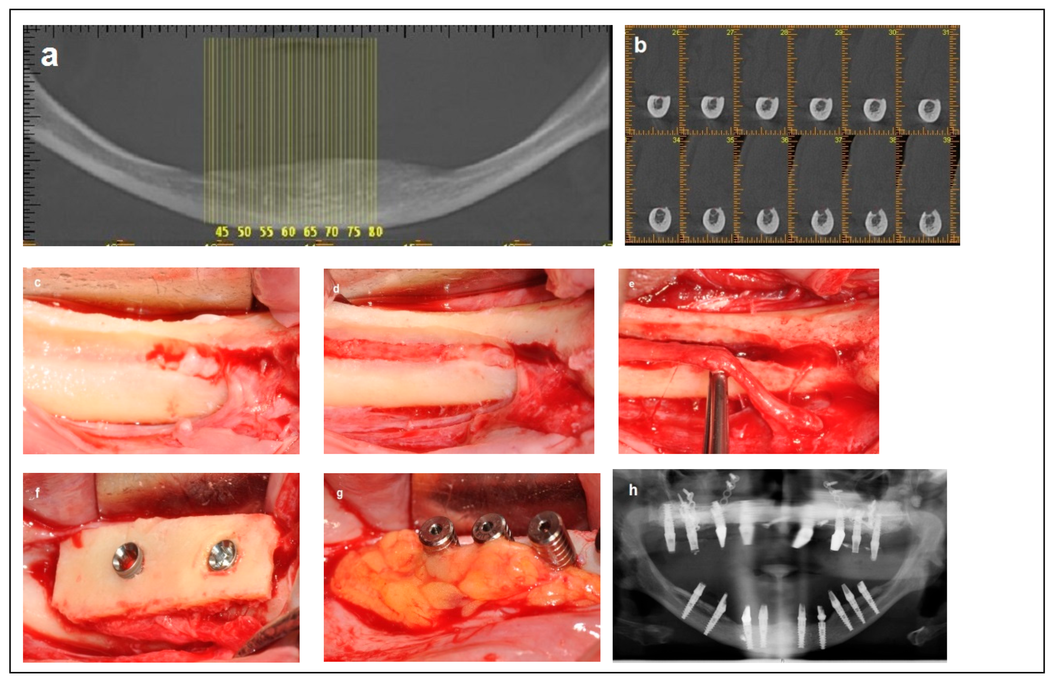 Dentistry 13 00267 g005