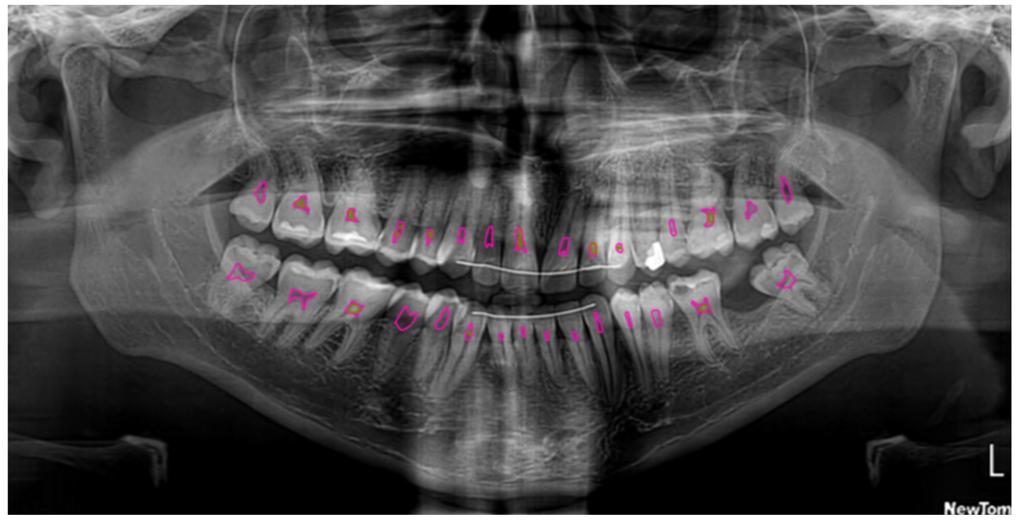 Dentistry 13 00274 g002