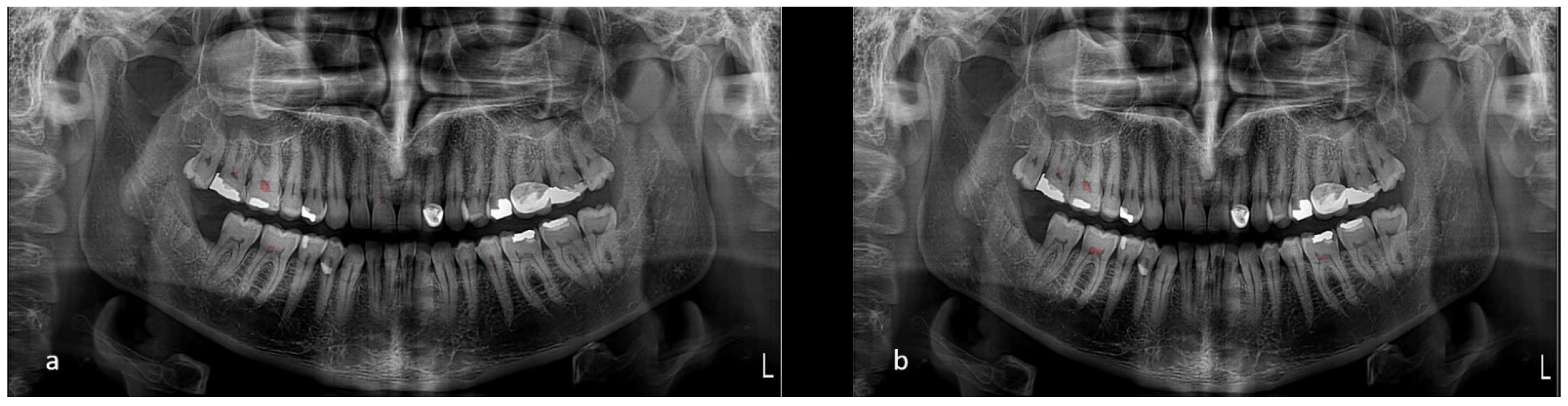 Dentistry 13 00274 g003