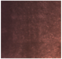 Dentistry 13 00277 i012