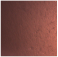 Dentistry 13 00277 i017